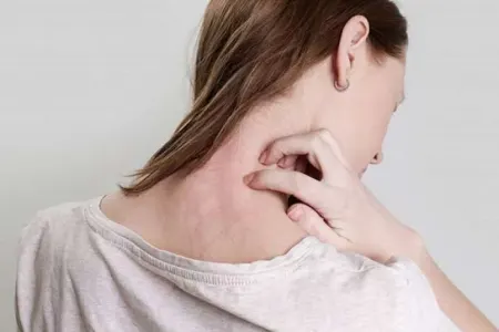 Bu xəstəlik sürətlə yayılır - Profilaktik tədbirlər görülməlidir