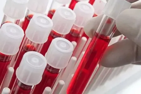 Ən ağıllı insanlar bu qan qrupundan olurlar – - Yapon alimlərinin araşdırması