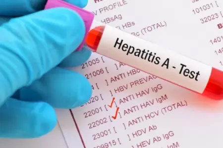 Hepatit A virusu yayılır - Ölənlər var