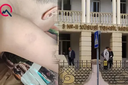 Xüsusi məktəbdə müəllim azyaşlıya şiddət göstərib? - Rəsmi açıqlama