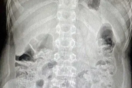 12 yaşlı uşaq pult batareyasını - UDDU
