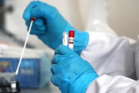 Xərçəngin yeni əlaməti açıqlandı