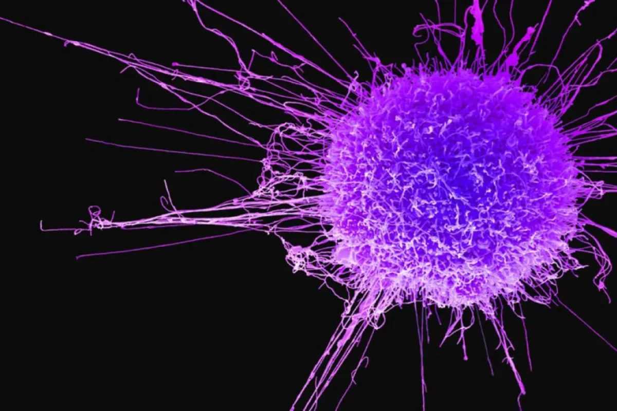 Bu qablar xərçəng yaradır - XƏBƏRDARLIQ