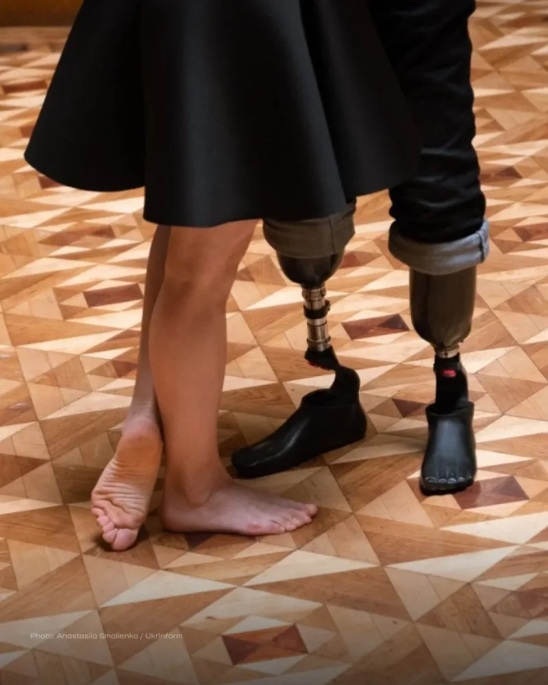 Hər iki ayağını itirən əsgərin ürək dağlayan - FOTOLARI