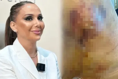 “Həkim məni 3 dəfə əməliyyat edib pis vəziyyətə qoydu”