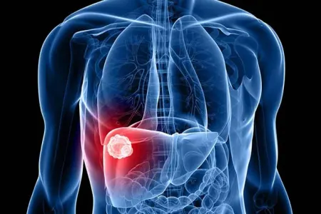 Qaraciyəri qoruyan 5 tərəvəz