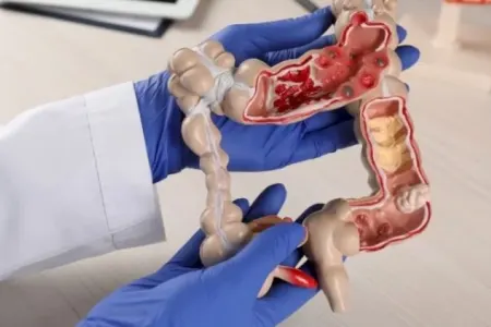 Tək bir səbəblə hər il 32 min nəfər xərçəng olur – - Yeni araşdırma ŞOK ETDİ