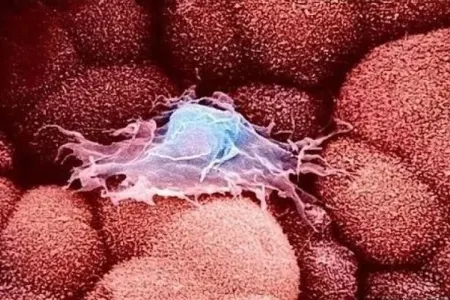 Xərçəng xəstəliyinə qarşı - “Troya atı”