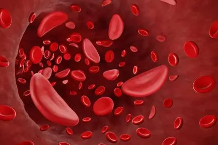 Xolesterinin səbəb ola biləcəyi xəstəliklər açıqlandı