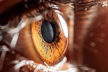 Göz rəngimiz qara ola bilməz: Əgər olsaydı, daim ağlayardıq