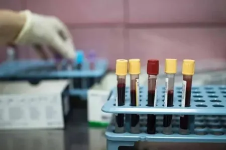 Xərçəngin bu növü Y nəslinin yeni kabusuna çevrilib