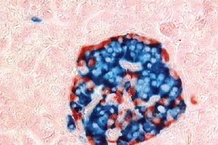 Xəstələr üçün yeni ÜMİD