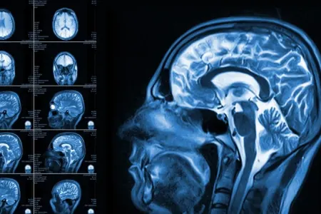 Beynimiz haqqında yeni kəşf: Gördüyünə deyil, gözlədiyinə inanır