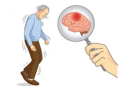 Parkinson xəstəliyi beyində deyil, böyrəklərdə başlaya bilər - -TƏDQİQAT