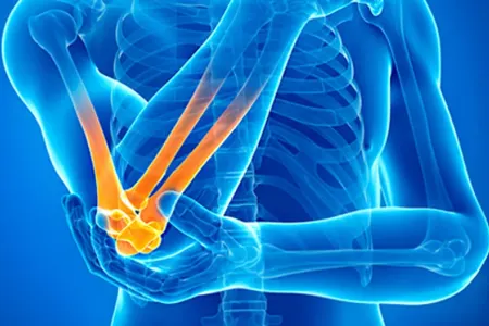 Mütəxəssislər artritlə mübarizədə - bu tərəvəzi tövsiyə edirlər