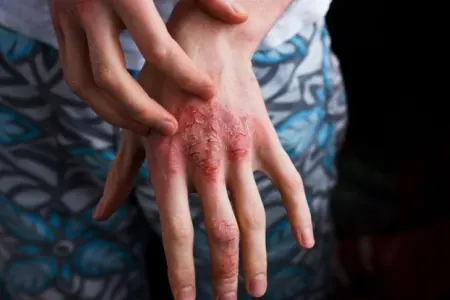 Əsəb və stress bu xəstəlikləri yaradır - "Qızıl 7-lik"