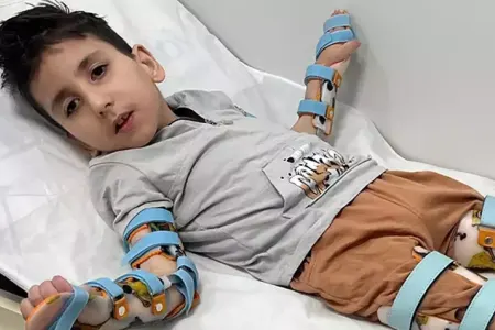 Milçək dişləməsi - HƏYATINI DƏYİŞDİ