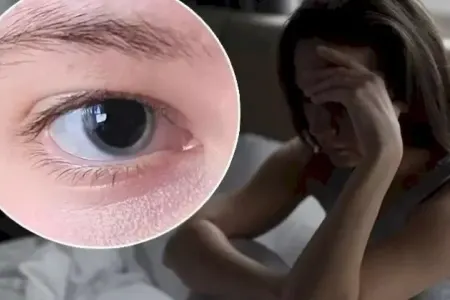 Selfi çəkdi, ölümcül xəstəliyini aşkar etdi