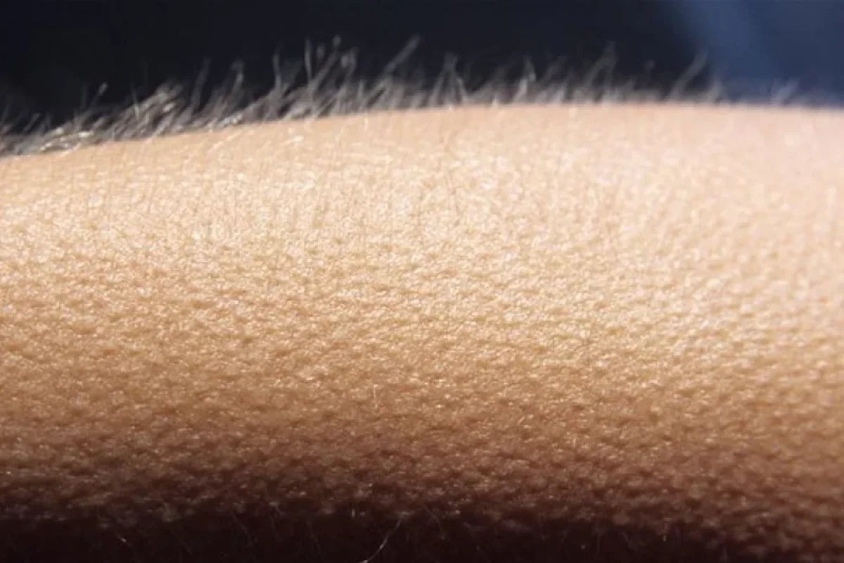 Tüklərin "biz-biz" olmasının səbəbi