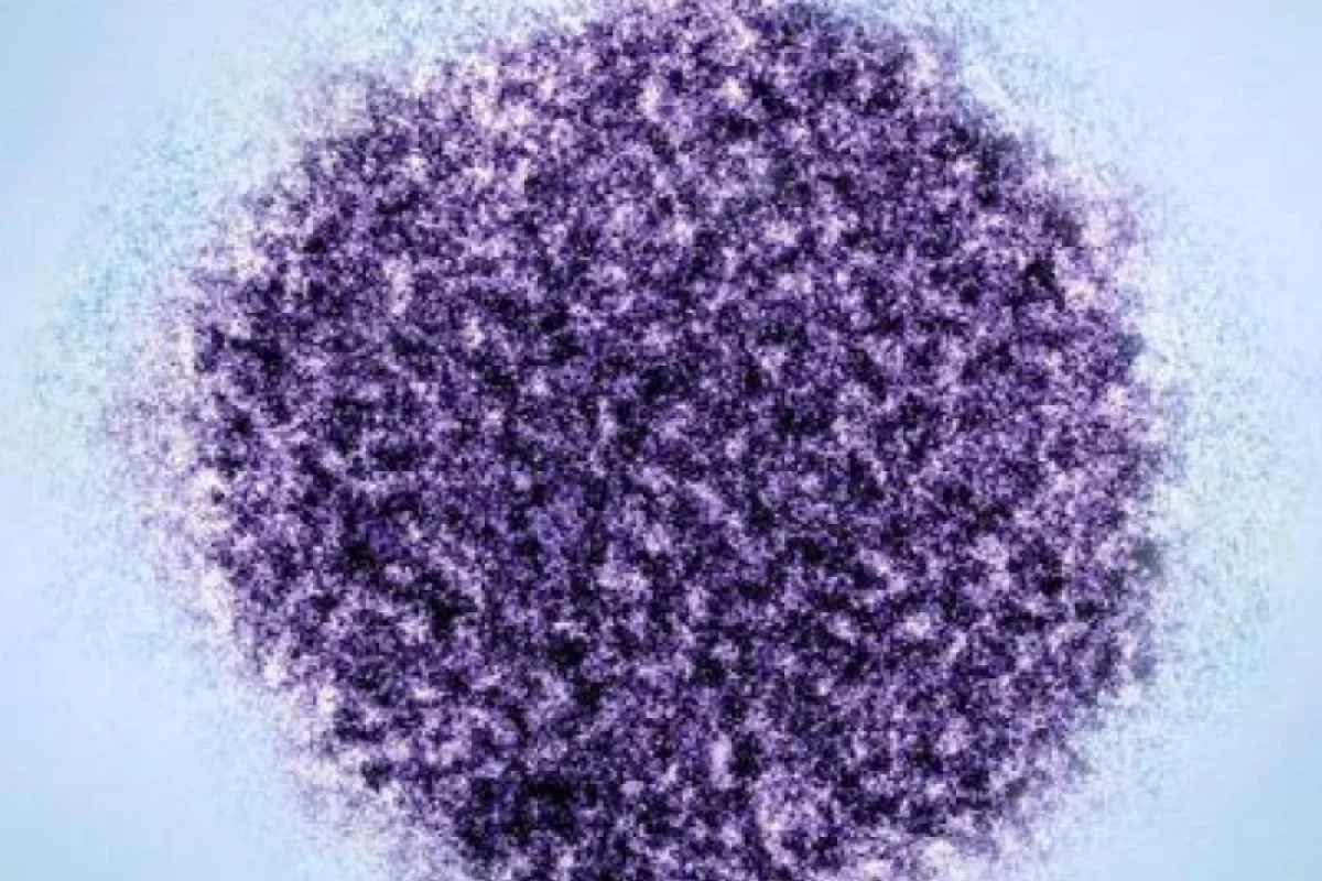 Hepatit C virusunun psixiatrik pozğunluqlarla əlaqəsi aşkarlanıb - TƏDQİQAT