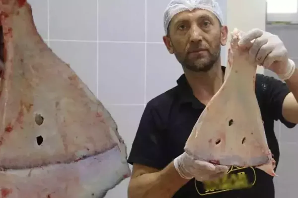 Caduyla mübarizə: 240 sümükdən ikisini qırırlar