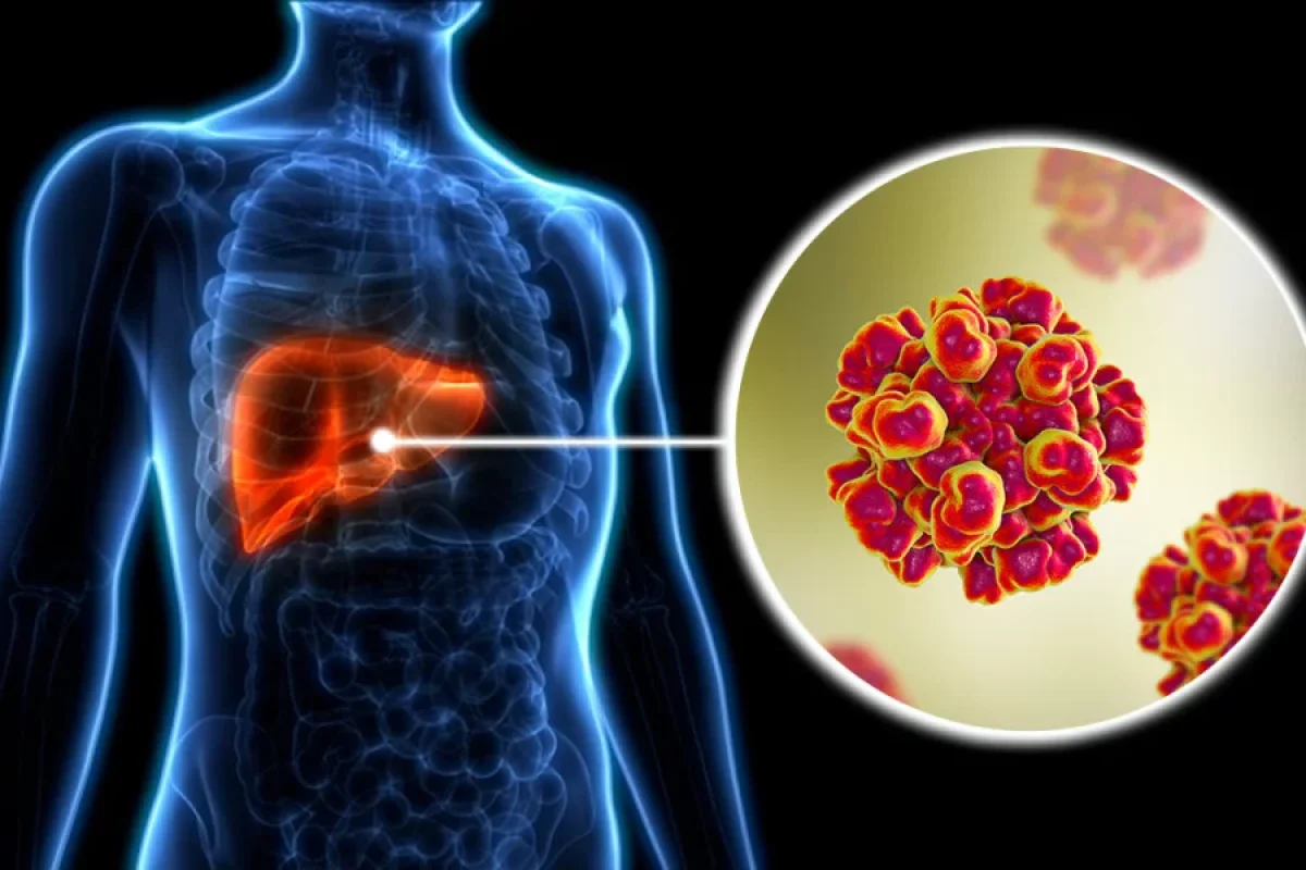 Hepatit E virusunu BƏSLƏYƏN ORQAN - Qaraciyərdə olduğu kimi...