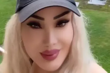 Məleykə Əsədova estetik etdirib?