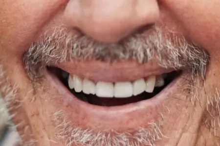 Gülə-gülə ölürlər: - Bu xəstəlikdən xilas olan yoxdur