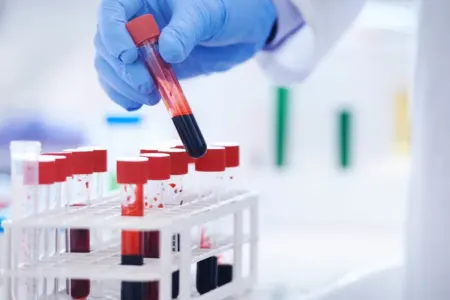 Unikal qan qrupu aşkarlandı