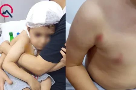 Azyaşlının atası: - "Uşağımı dişləyən it quduz imiş"