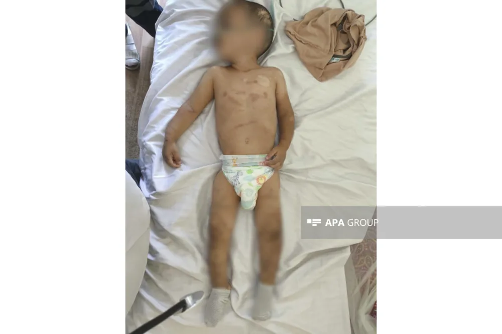 Ağdamda ata 2 yaşlı uşağını ölümcül döydü - FOTO