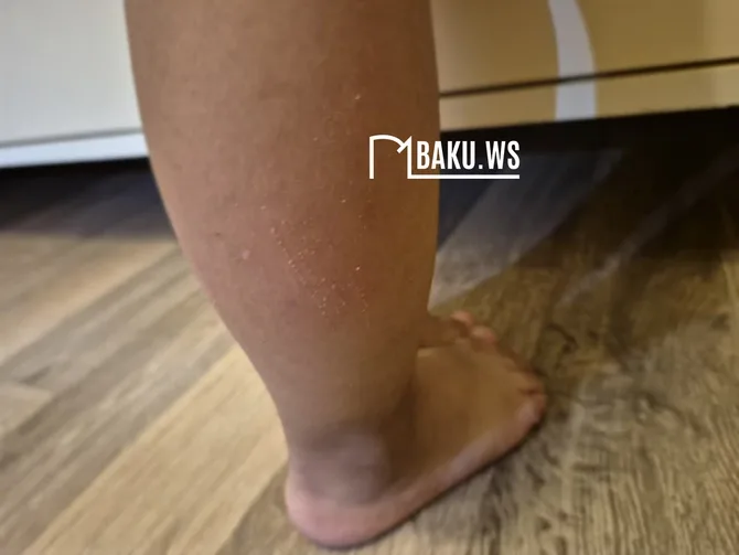 "Mərkəzi Park"da 2 yaşlı uşaq kanalizasiya quyusuna düşdü - FOTO