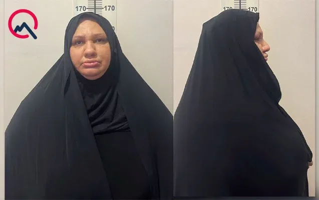 14 yaşlı bacısı oğluna işgəncə verən xalanın - FOTOSU