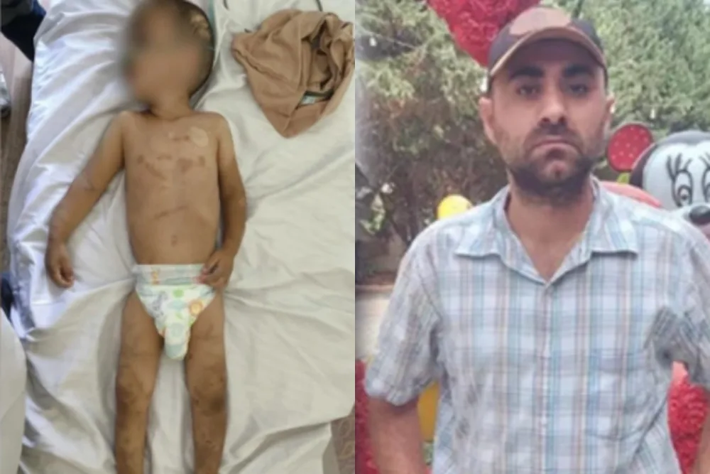 Ağdamda atası tərəfindən döyülən azyaşlının vəziyyəti - AÇIQLANDI - FOTO