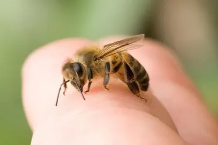Arı sancması hansı hallarda ölümə səbəb olur? - Mütəxəssis açıqladı