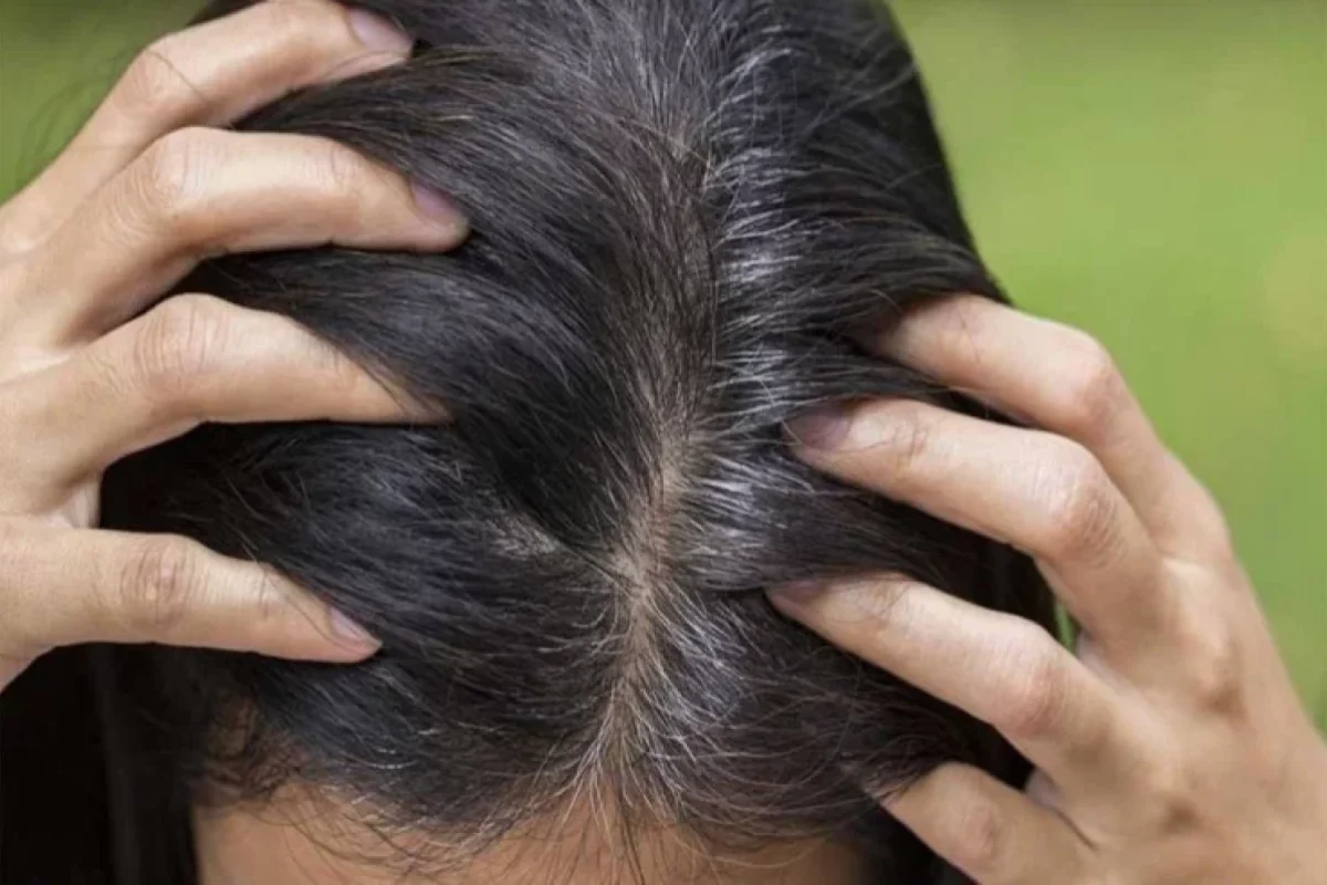 Saçdakı ağ tellərə qarşı ev üsulu maska