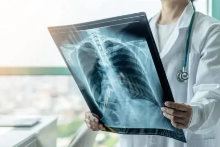 Vərəmlə mübarizə yetərsizdir, - ictimai dinləmə keçiriləcək