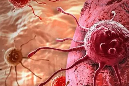 Dilindəki ağrı xərçəng əlaməti imiş