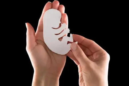 Abortların sayı artıb