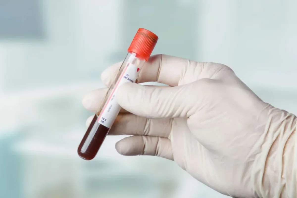 Yaşlı qadının bədənində tapılanlar həkimləri şoka saldı: Görün nələr çıxdı