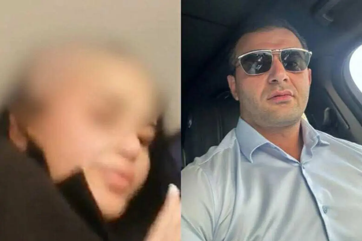 Həyat yoldaşının başını keçəl edən şəxs həbs olundu