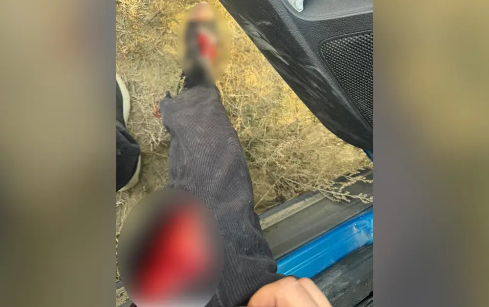 AzTV-nin müxbiri təyyarənin qəzaya düşdüyü ərazidə yaralandı - Foto