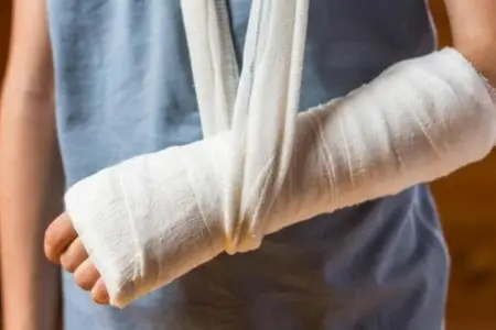 “Travma yalnız sınıq deyil” — Mütəxəssis bərpa prosesinin sirlərini açdı