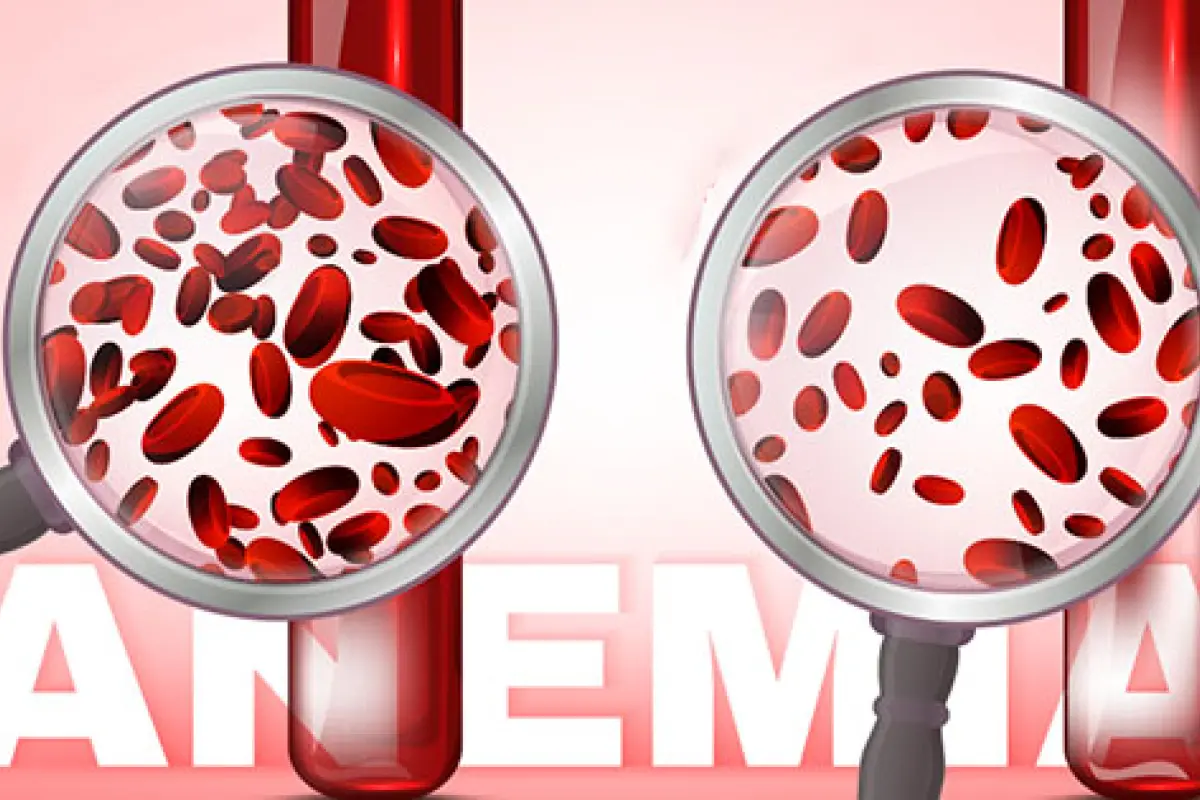 Uzunmüddətli antibiotik istifadəsi qan azlığına səbəb ola bilər - Xəbərdarlıq 