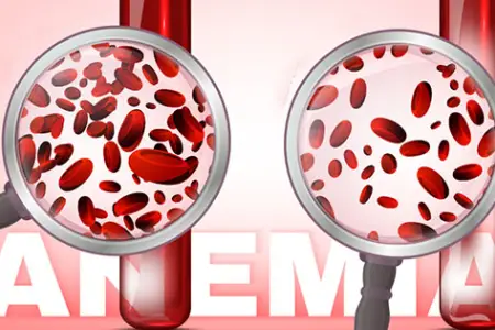 Uzunmüddətli antibiotik istifadəsi qan azlığına səbəb ola bilər - Xəbərdarlıq 