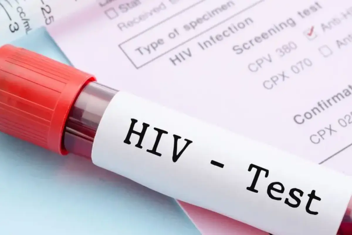 Avropada HİV “səssiz böhran”a çevrilir
