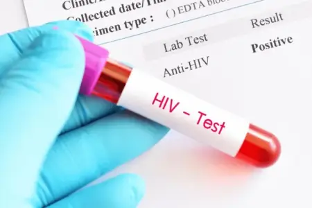 Azərbaycanda İİV-ə yoluxanların sayı açıqlandı