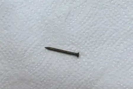 Bakıda azyaşlının mədəsindən mismar çıxarıldı - Foto