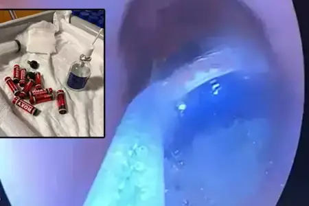 Türkiyə həbsxanasında dəhşətli hadisə: Məhkum 9 batareya və 3 ülgüc uddu