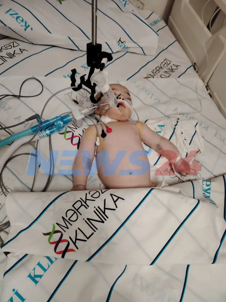 "Dəfnə hazırlaşanda uşaq ayıldı..." - Valideynlər həkimləri ittiham edir